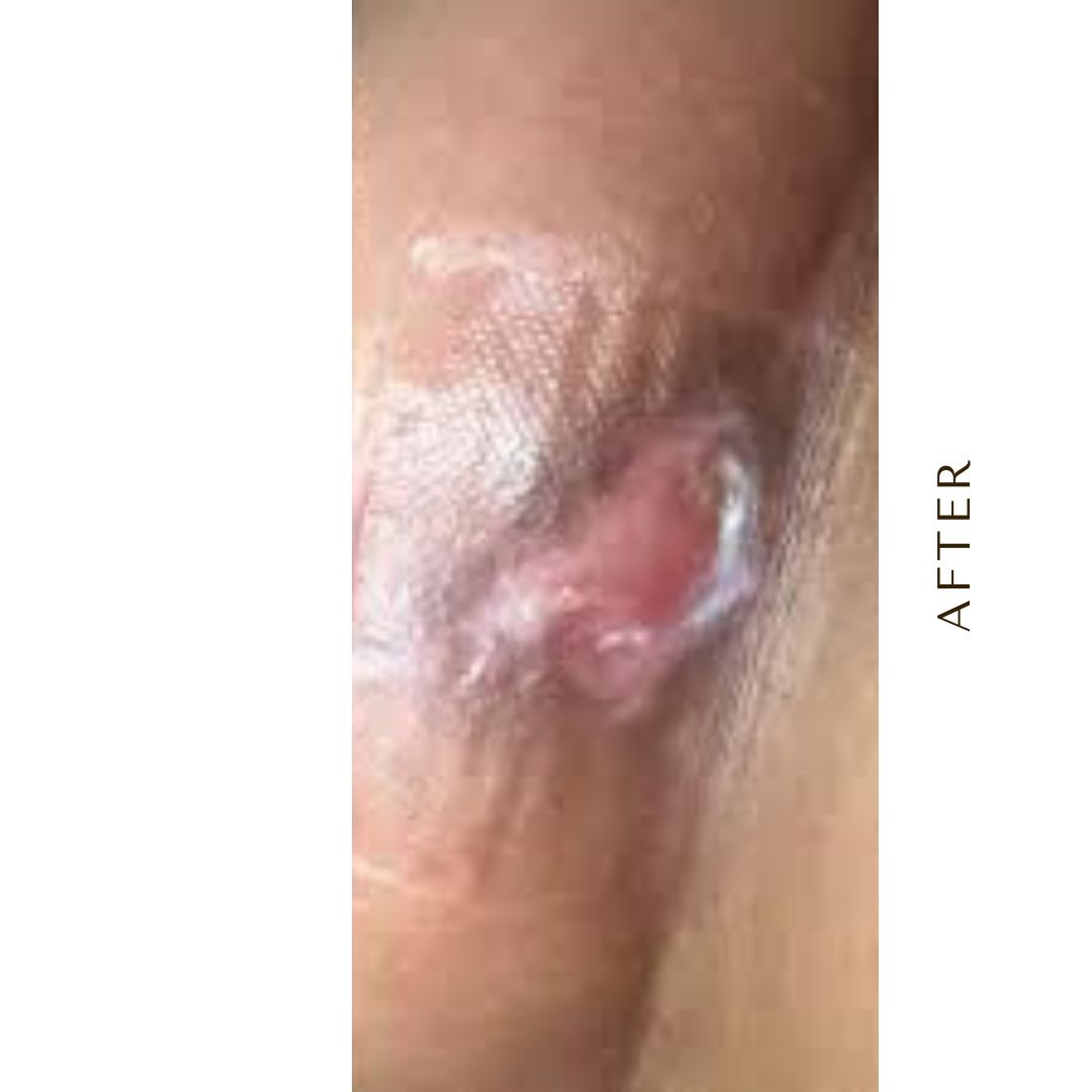 26