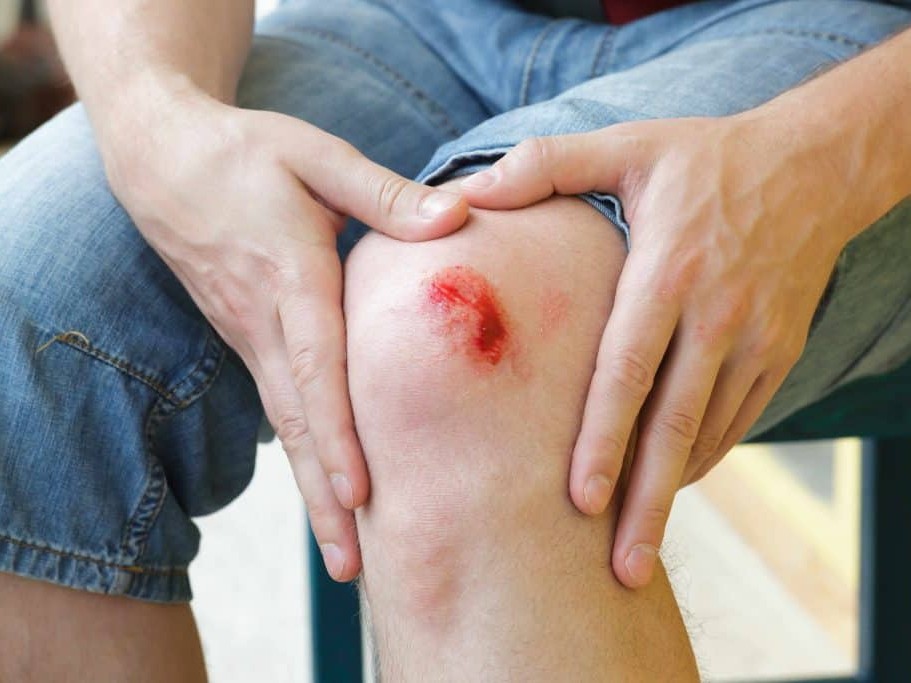 When to See a Doctor for a Wound: 5 Key Warning Signs