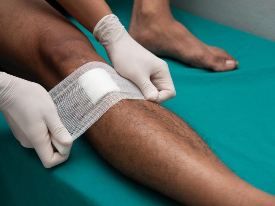The Role of Advanced Dressings in Chronic Wound Care