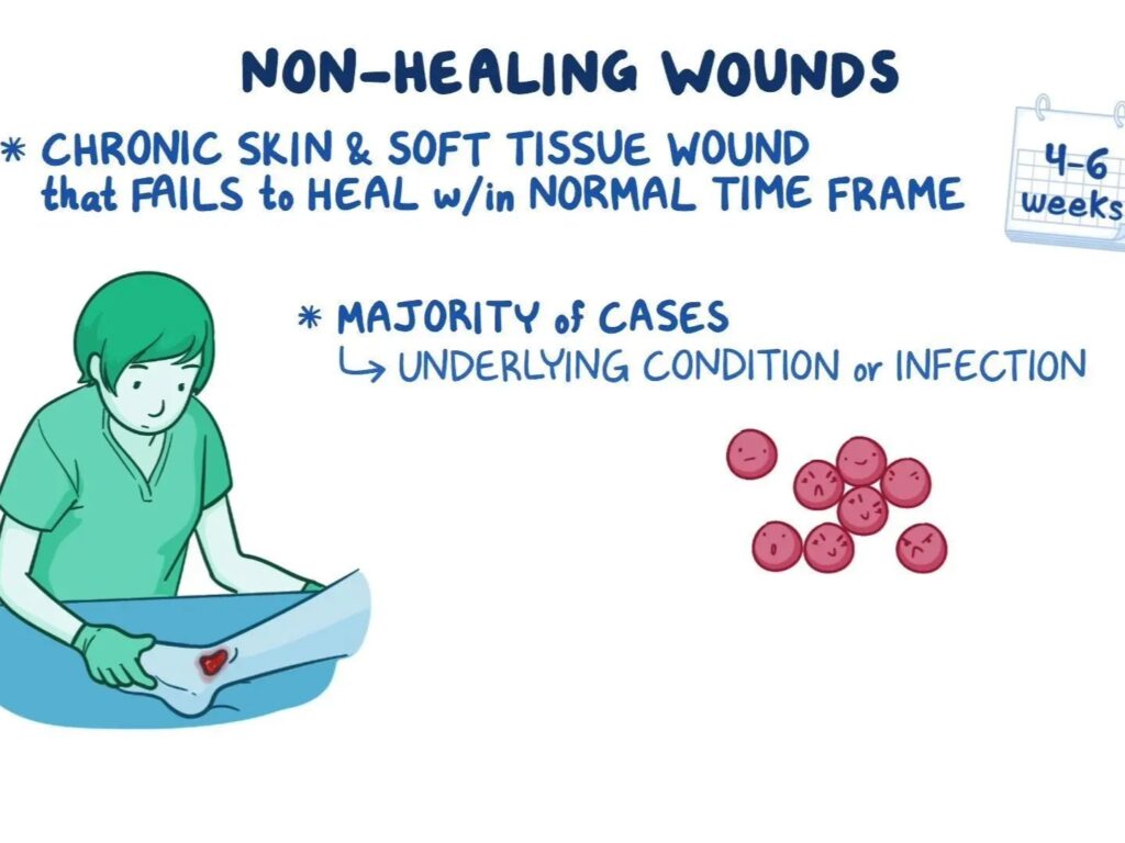 A close-up view of a chronic, non-healing wound on the lower limb, showing prolonged tissue damage and inflammation. The skin around the wound appears discolored and swollen.