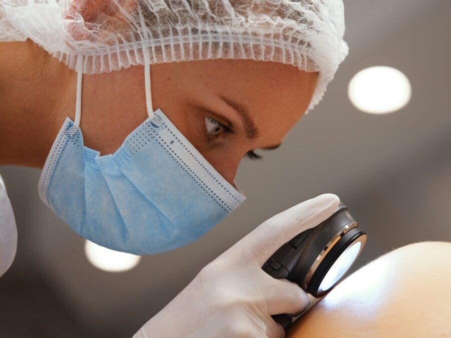 Skin showing radiation-induced wound with redness and tissue damage.